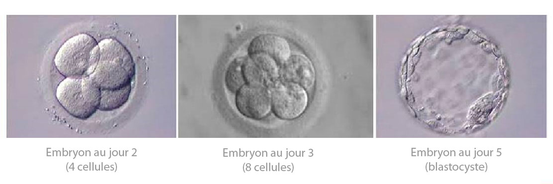 Transfert embryon frais - CPMA